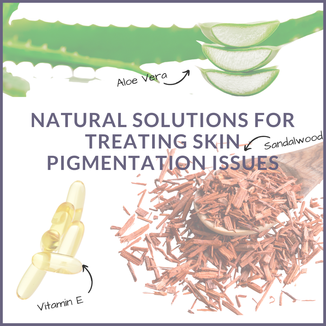 3 natural solutions for treating pigmentation issues.  Aloe Vera, Vitamin E and Sandalwood. perfecting aloe vera