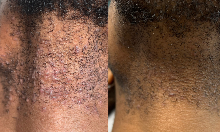 Virtual Skincare Consultation