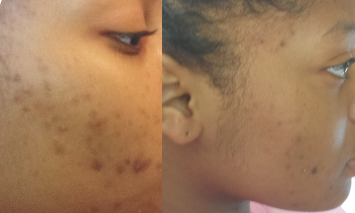 Virtual Skincare Consultation