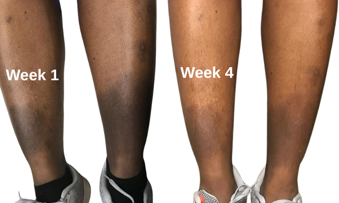 Virtual Skincare Consultation