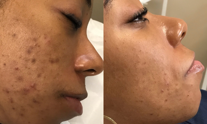 Virtual Skincare Consultation