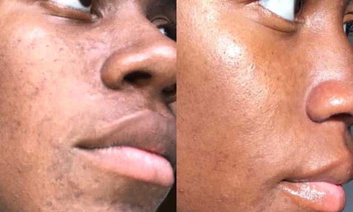 Virtual Skincare Consultation