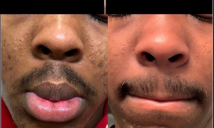 Virtual Skincare Consultation