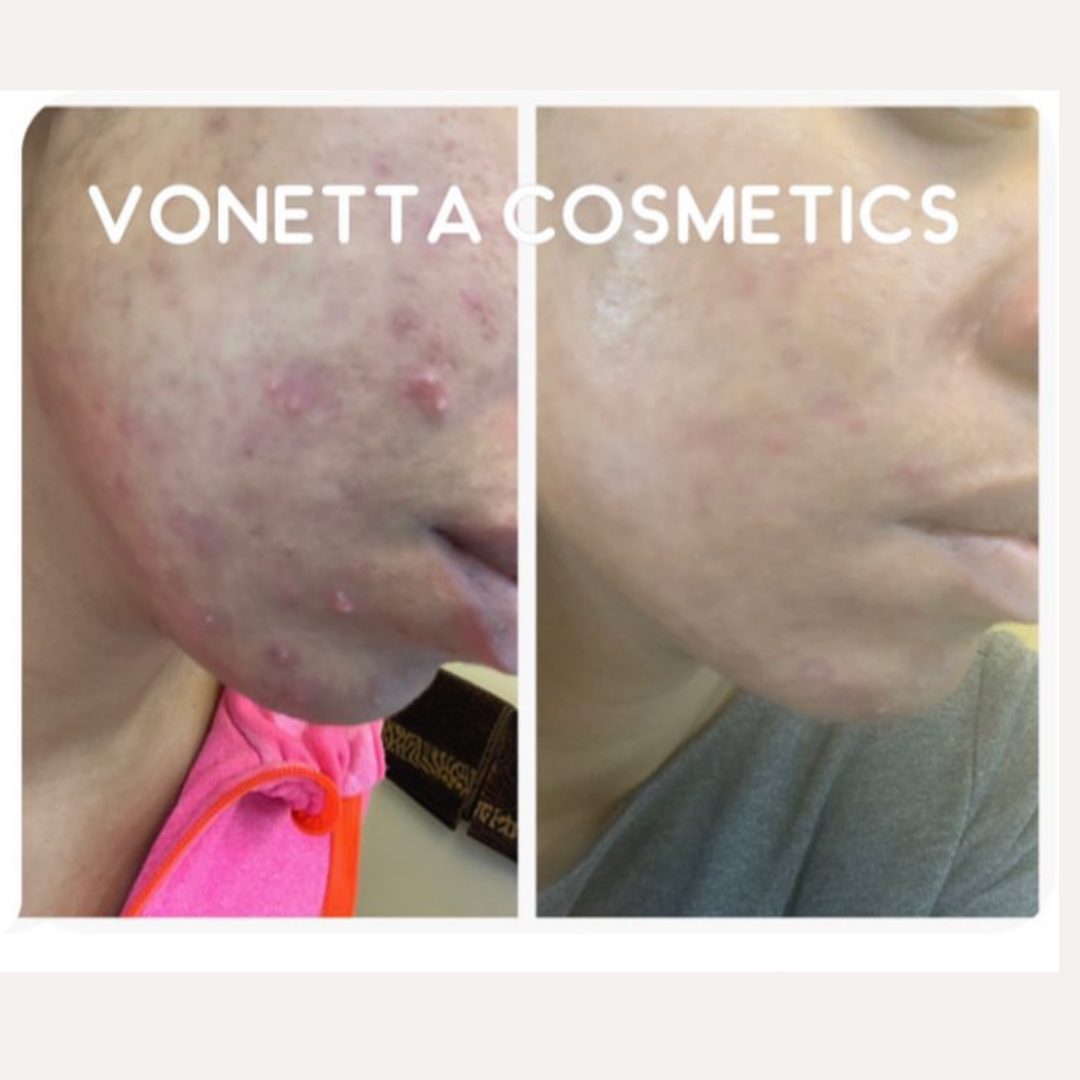 Virtual Skincare Consultation