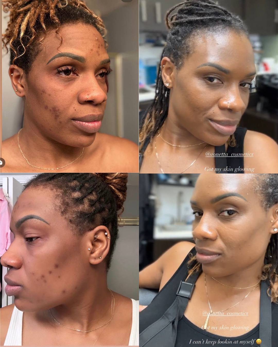 Virtual Skincare Consultation